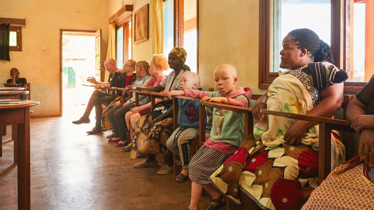 albinos en mozambique que optan por los Premios al Voluntariado Universitario de la Fundación Mutua Madrileña