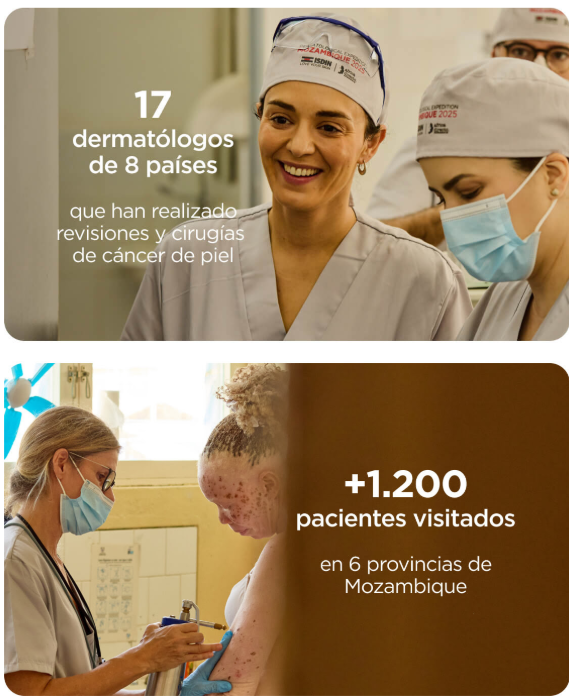 Parte superior: grupo de profesionales sanitarios con gorros y uniformes blancos en una sala clínica. Texto: “17 dermatólogos de 8 países que han realizado revisiones y cirugías de cáncer de piel”. Parte inferior: profesional médico con mascarilla examina la espalda de un paciente con cabello rubio rizado. Texto: “+1.200 pacientes visitados en 6 provincias de Mozambique”.
