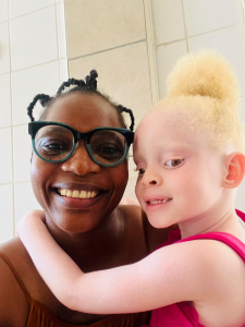 lucha contra el cáncer de piel proyecto mozalbinismo áfrica directo isdin niños albinos