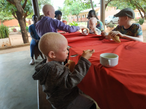 niño albino comiendo con otros niños albinos de mozambique